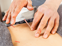 腰痛や肩こりに鍼灸治療